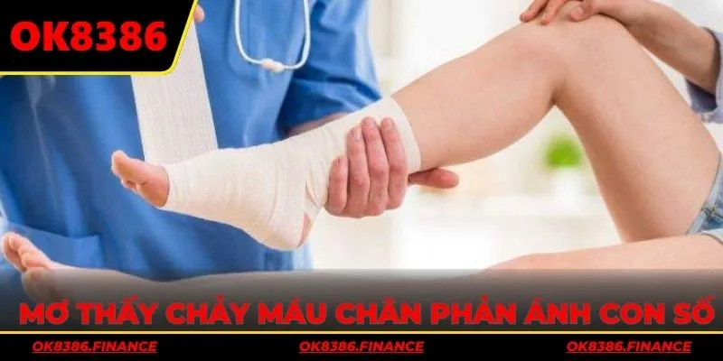 Mơ thấy chảy máu chân phản ánh những con số lô đề hấp dẫn